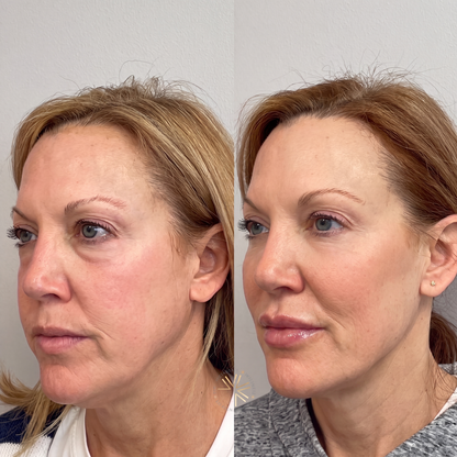 Syne Volume Boosting Serum