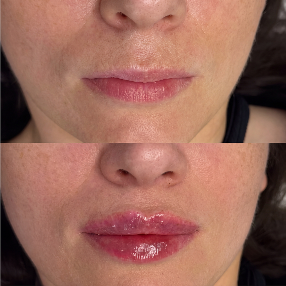 Syne Volume Boosting Serum [lip plumping lp]